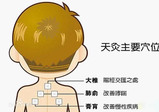 【医讯】中医康复二区开展“三九贴”理疗项目