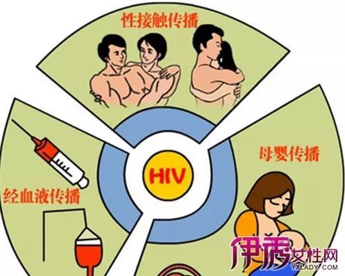 艾滋病宣传月,你准备好了吗？